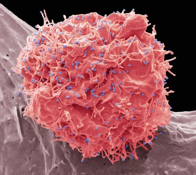 HIV infected cell, SEM