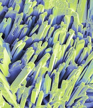 Gallstone crystals, SEM