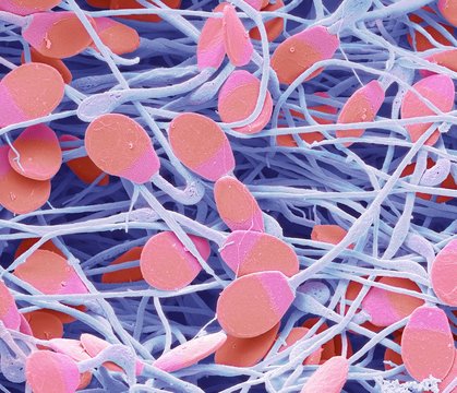 Sperm, SEM