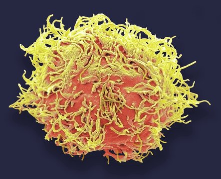 Mesenchymal Stem Cell, SEM