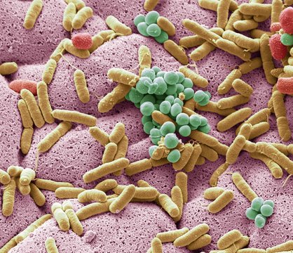 Bacteria found on dishcloth, SEM