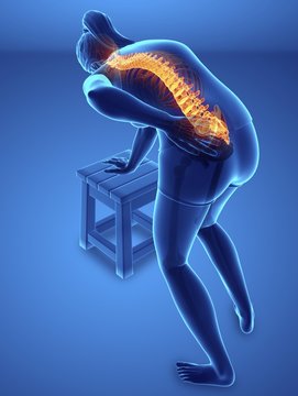 Woman with back pain, illustration
