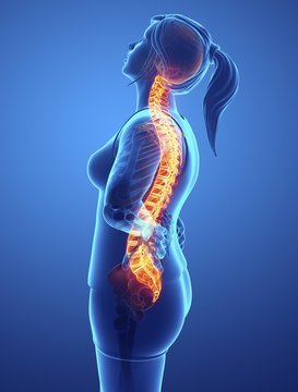 Woman with back pain, illustration