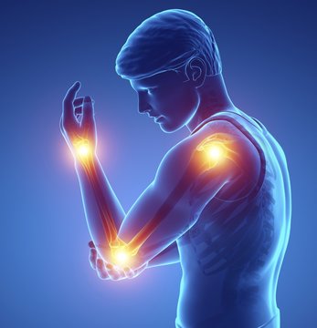 Man with arm pain, illustration