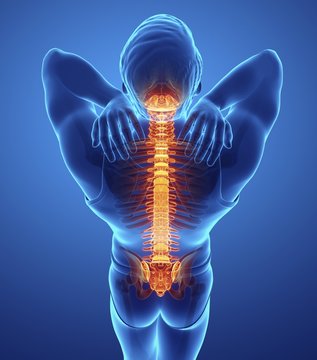 Man with back pain, illustration