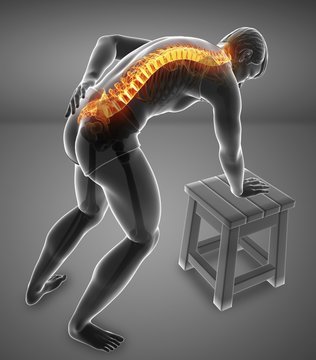 Man with back pain, illustration