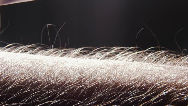 Arm Hair Rising During Listening The Music