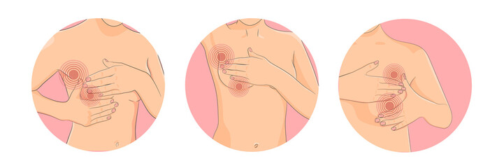 Breast self exam ill