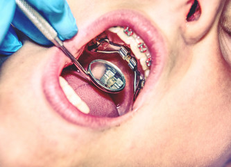 Patient with  dental braces during check or  treatment