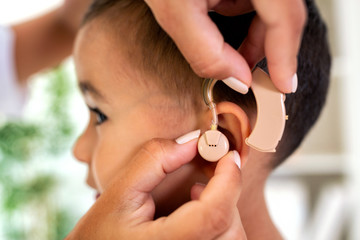 Helping little child to hear sound again