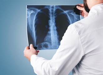 Young male doctor examining x-ray