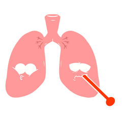 flat color style cartoon unhealthy lungs
