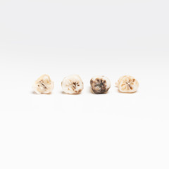 pulled out bad molars human teeth close up on white background