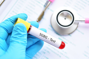 Blood sample tube for sex hormone binding globulin or SHBG test
