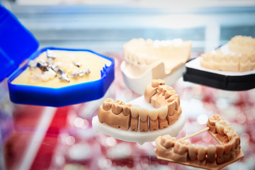 various samples of casts of dentures, close up