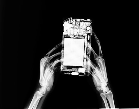 hands skeleton and mobile phone on x-ray