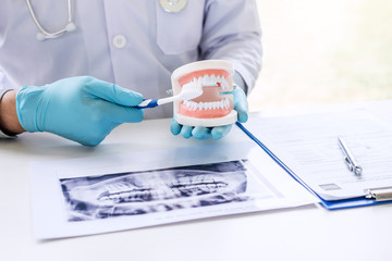 Dentist hand holding of jaw model of teeth and cleaning dental with toothbrush