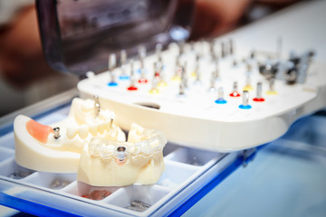 various samples of casts of dentures, close up