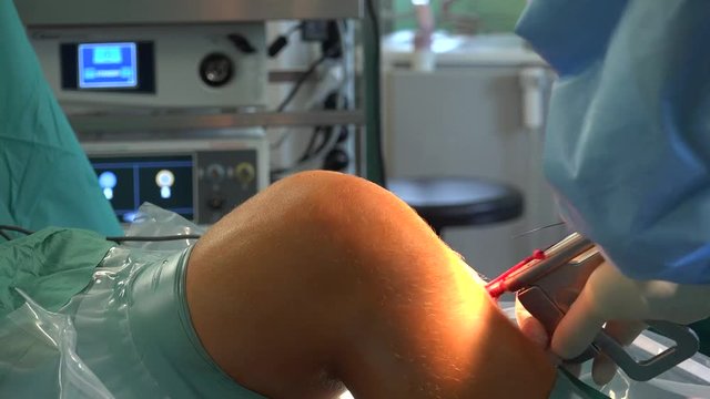 Knee Surgery and Anterior Cruciate Ligament 4