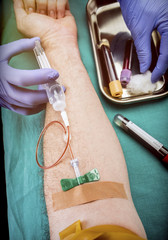 Nurse draws blood to a blood donor in a hospital, conceptual image