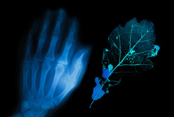 x-ray human hand and leaf of a tree in comparison. The concept of destruction and damage to bones and tissues