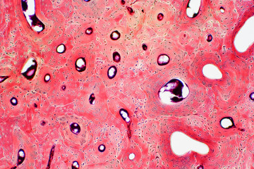 Histology of human compact bone tissue under microscope view for education