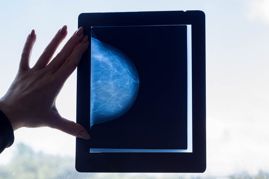 Doctor looks at a breast mammography image