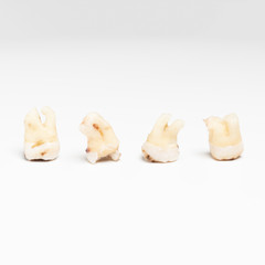 pulled out bad molars human teeth close up on white background