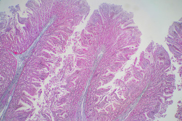 Human large intestine tissue under microscope view