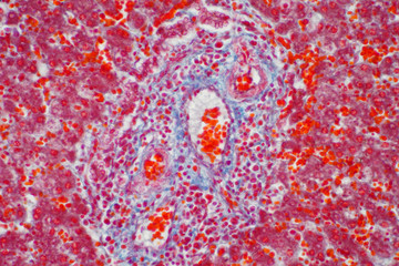 Human liver tissue under the microscope view.