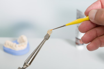 Zahnkrone wird im Zahnlabor eingefärbt
