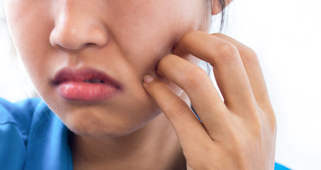 A women is itching and scratching the face.