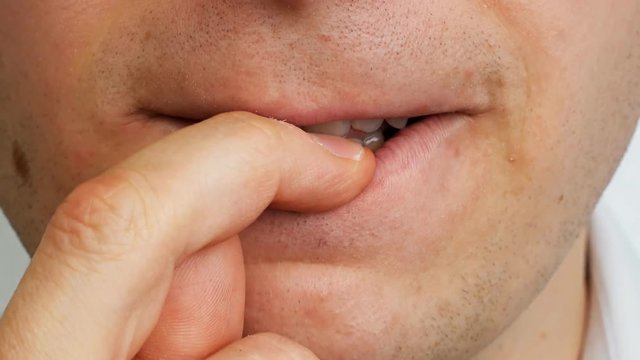 man by teeth eats his nail on finger, close up, human problem