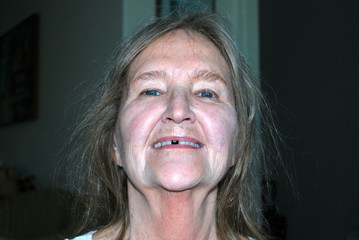Mature female senior expressions with a missing tooth cap.