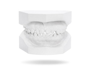 Dental gypsum model of teeth isolated on white background. Template of teeth made from plaster. Clipping paths object.