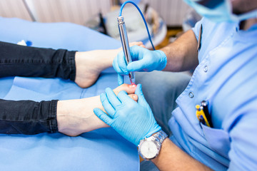 Toenail fungus treatment with foot laser at laser nail therapy clinic..