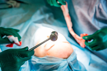 Surgeon and his assistant performing cosmetic surgery on nose in hospital operating room. Nose reshaping, augmentation. Rhinoplasty.