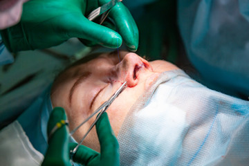 Surgeon and his assistant performing cosmetic surgery on nose in hospital operating room. Nose reshaping, augmentation. Rhinoplasty.