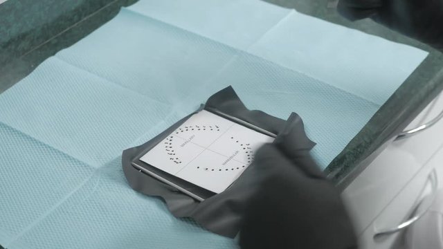 Dentistry rubber dam (cofferdam) installation procedure. Dental treatment, modern technology