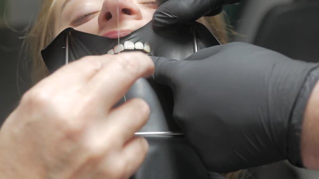 Dentistry cofferdam installation procedure. Dental treatment, modern technology