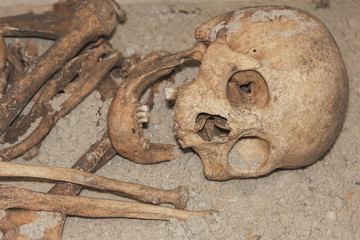 Archaeologists excavated the skeleton of a Neanderthal bones and skull with an open mouth in the ground. Prehistoric, Stone Age, Ice Age. Human remains.