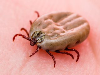 Encephalitis Virus or Lyme Disease Infected Dermacentor Tick Arachnid Insect on Skin Macro