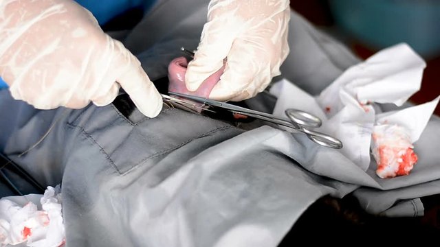 Vet doing the operation for sterilization. The cat on the operating table in a local clinic. Cat in a veterinary surgery ,