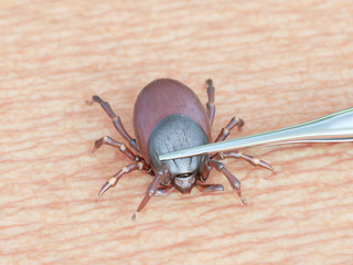 3d rendered illustration of a tick being removed
