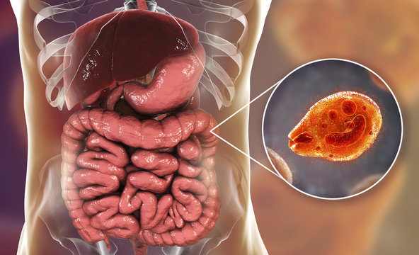 Balantidium coli protozoan in large intestine, 3D illustration. Ciliated intestinal parasite that causes balantidiasis