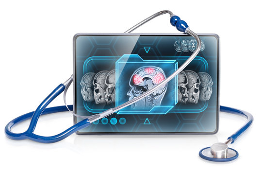 Modern medical tablet displaying brain activity scan, isolated on white background