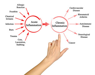 Acute and Chronic  Inflammation