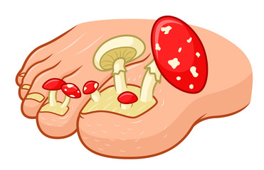 Cartoon nail fungus