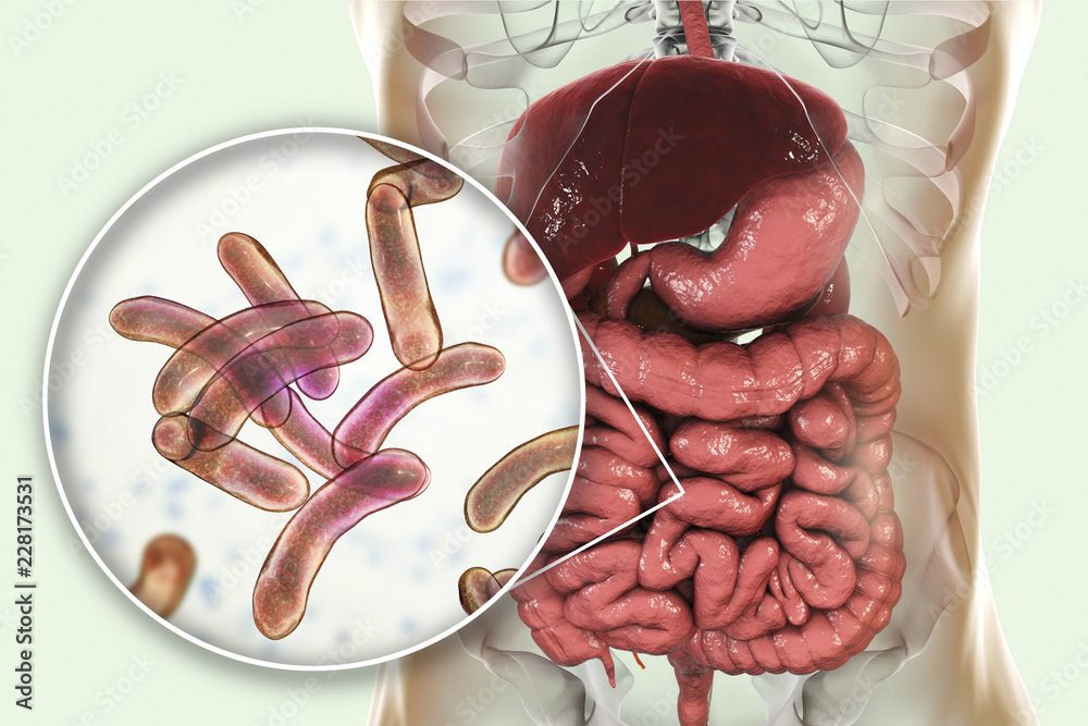 Poster vibrio cholerae bacteria in small intestine, 3d illustration. bacterium which causes cholera disease