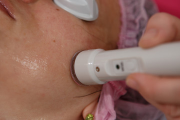 Laser hair removal from the face. Woman in the clinic of aesthetic medicine.